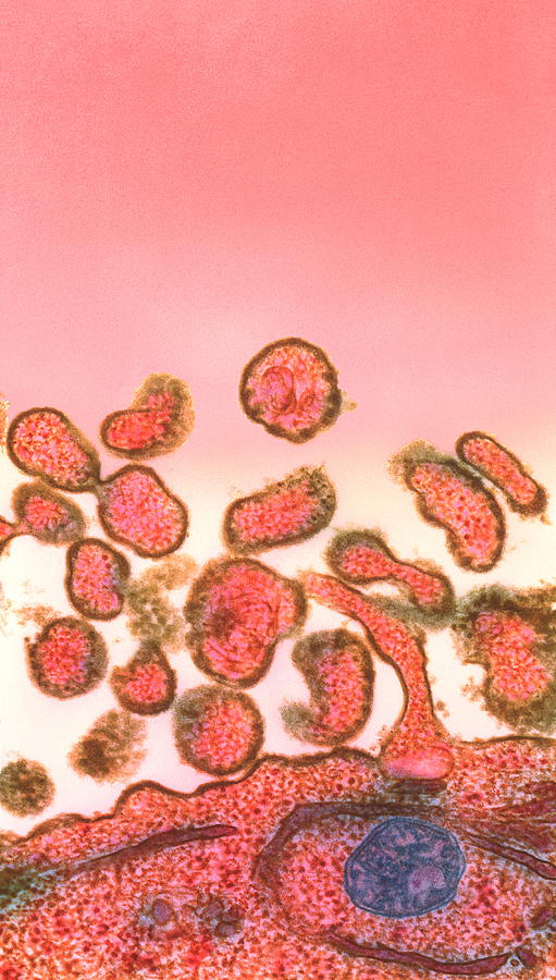 Measles Virus Photograph by Nibsc/science Photo Library