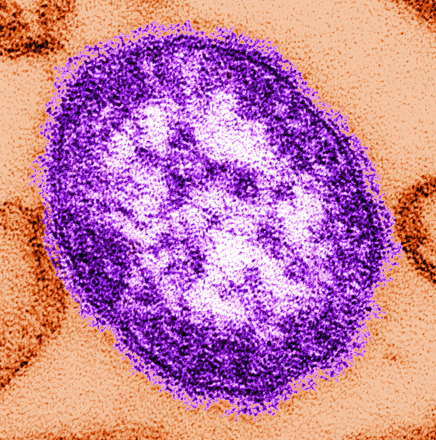 Measles Virus, Tem Photograph by Science Source