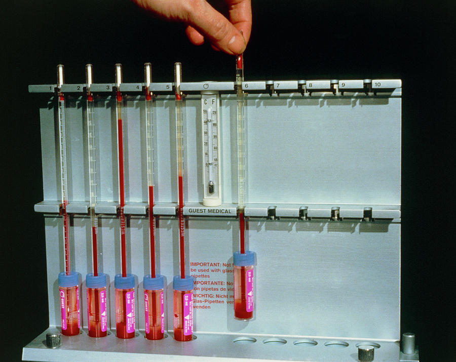 Measurement Of Esr Of Blood Photograph by Science Photo Library. Pixels