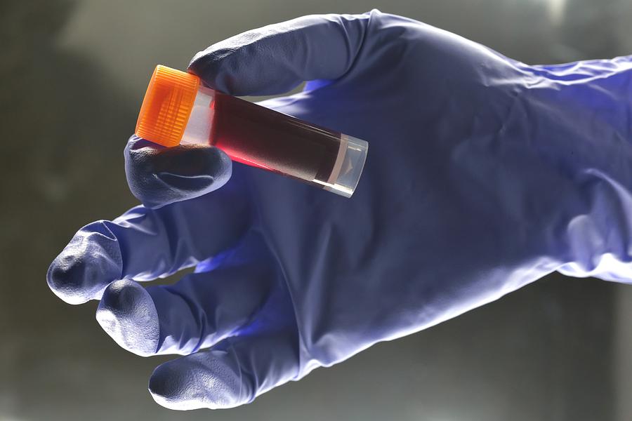 Medical Lab technician hold sample blood for testing Photograph by Douglas Sacha