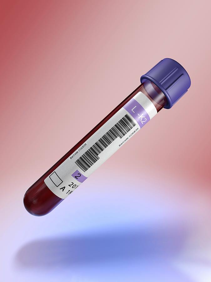 Medical Test Tube With Blood Photograph by Alfred Pasieka/science Photo Library