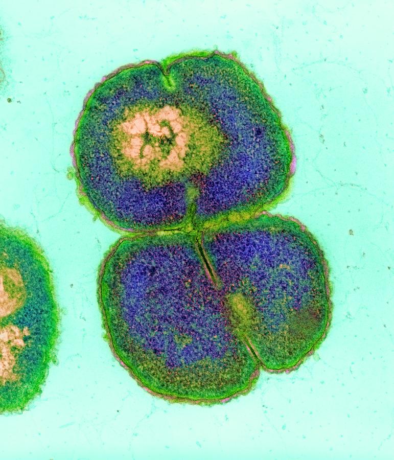 Meningitis Bacteria Photograph by A. Dowsett, Public Health England/science Photo Library