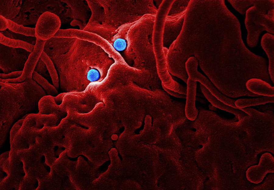 Mers Coronavirus Particles, Sem Photograph by Science Source