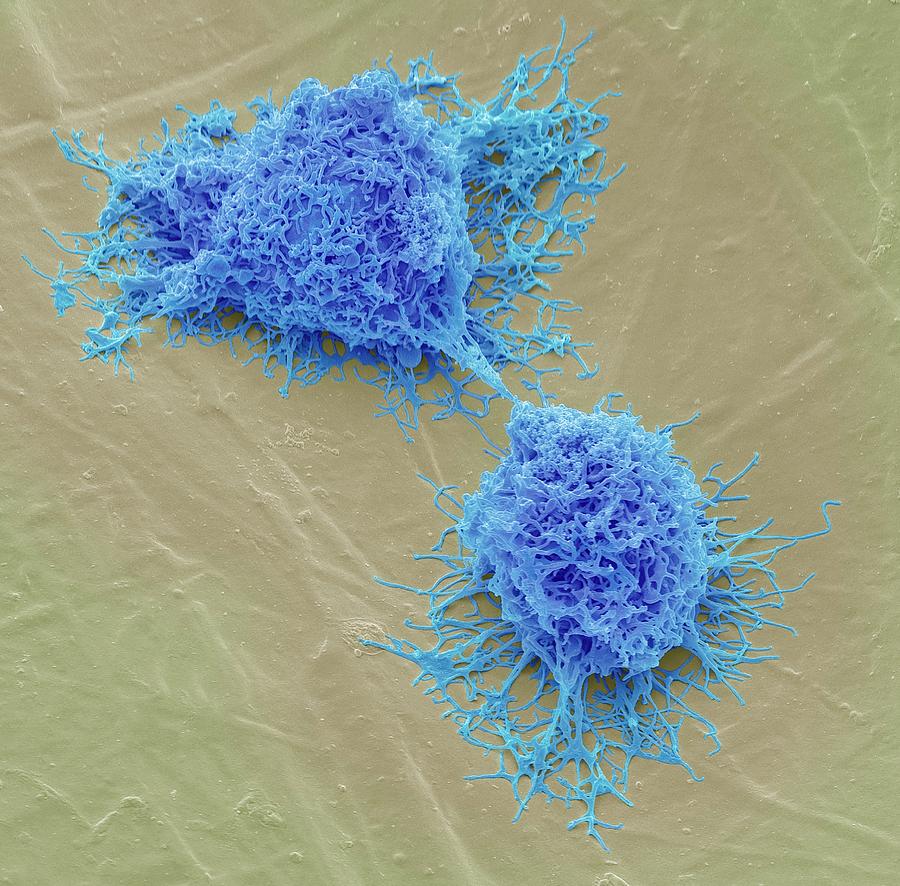 Mesenchymal Stem Cells Photograph by Steve Gschmeissner