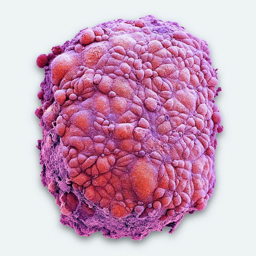 Mesothelioma Spheroid Photograph by National Cancer Institute/science Photo Library