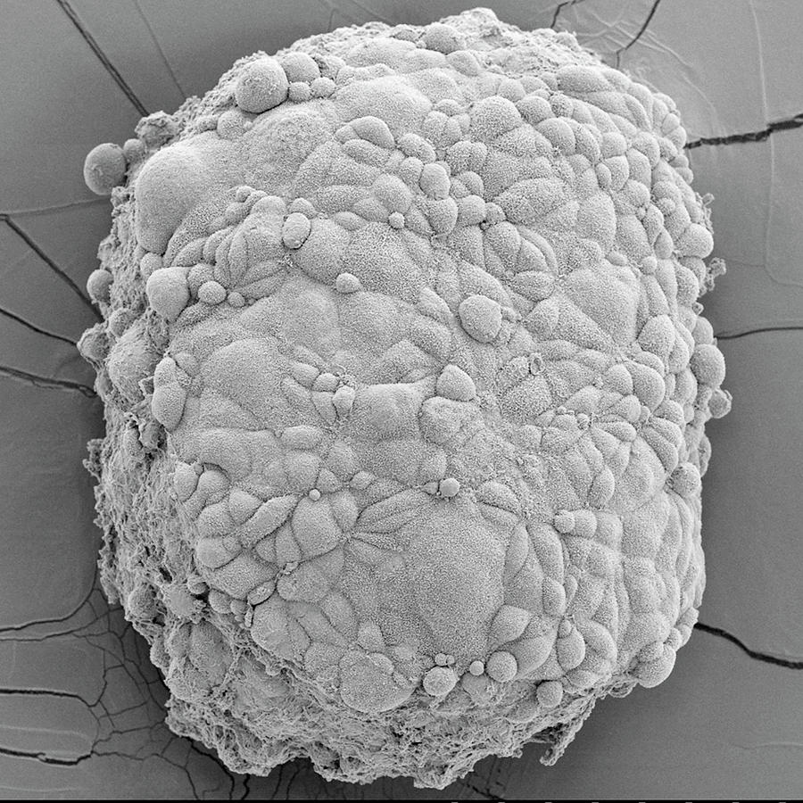 Mesothelioma Spheroid Photograph by Nci Center For Cancer Research/national Cancer Institute/science Photo Library