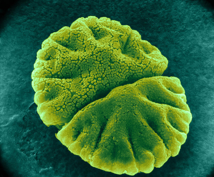 Micrasterias Angulosa, Algae, Sem Photograph by Jerome Pickett-Heaps