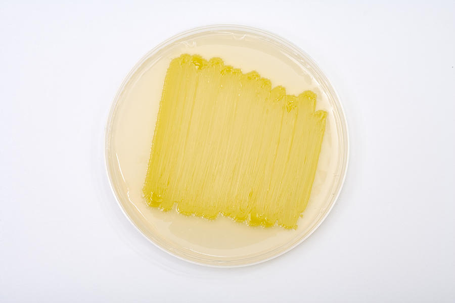Micrococcus Luteus Culture Photograph by Science Stock Photography