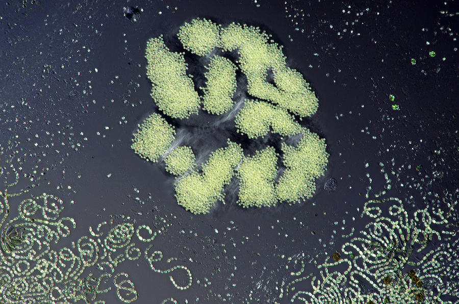 Microcystis And Anabaena Spiroides, Lm Photograph by Marek Mis