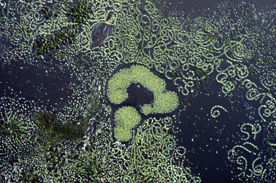 Microcystis, Lm Photograph by Marek Mis