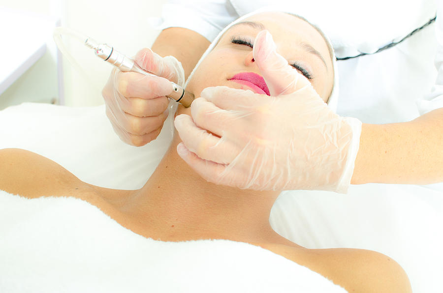 Microdermabrasion treatment Photograph by GregorBister