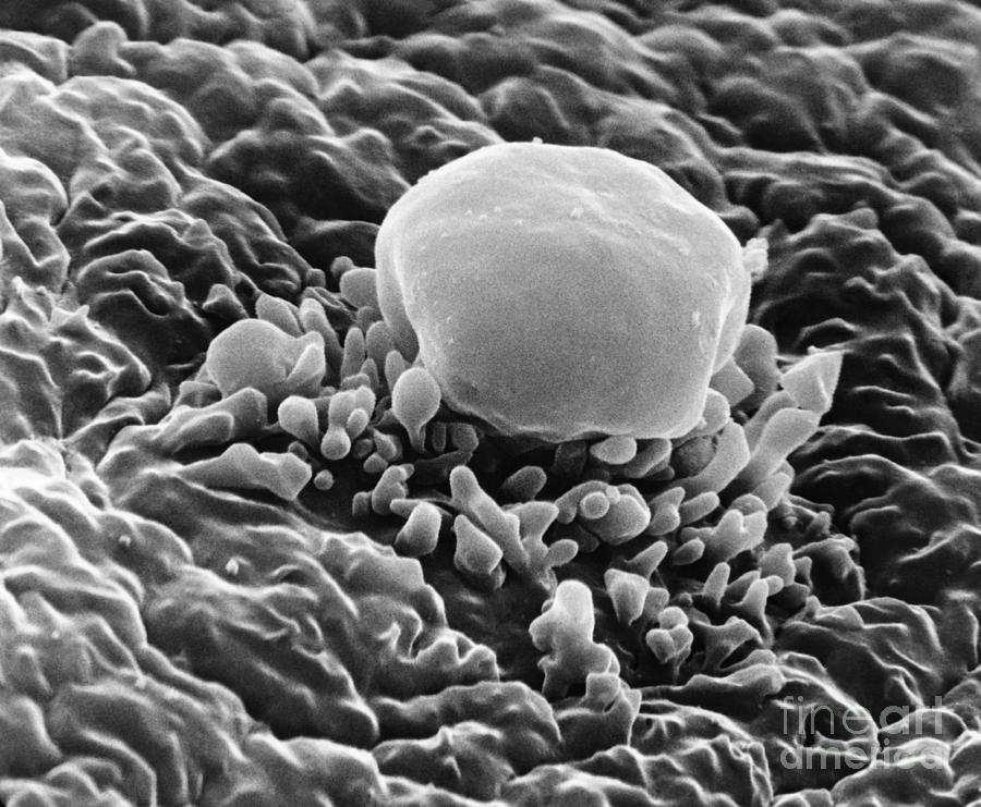 Micropile, Zebrafish Egg Sem Photograph by David M. Phillips Fine Art