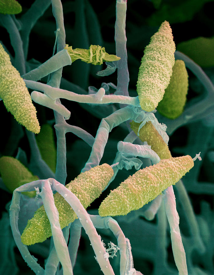 Microsporum Fungus Photograph by Eye of Science