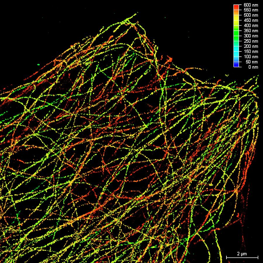Microtubules Photograph by Ammrf, University Of Sydney