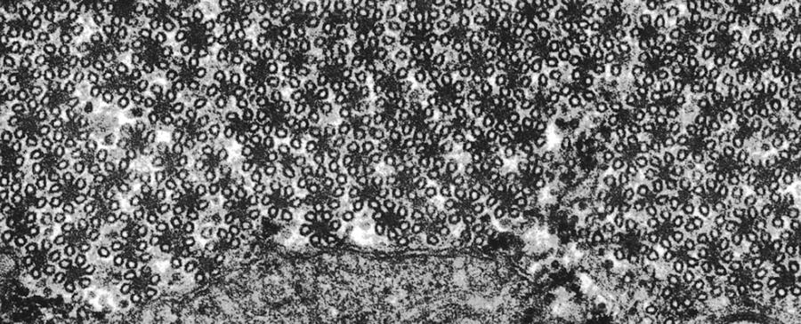 Microtubules, Ciliated Protozoan, Tem Photograph by Greg Antipa
