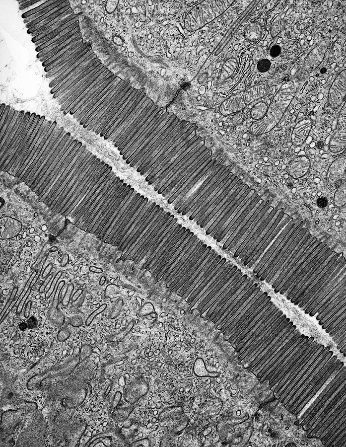 Tissue Photograph - Microvilli by Microscape