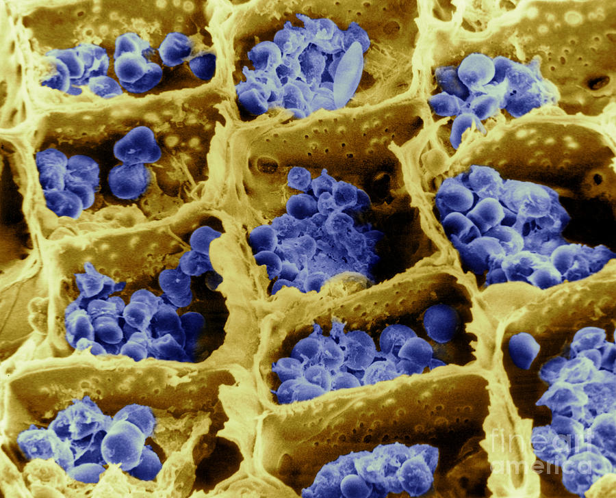 Scanning Electron Micrograph Photograph - Mimosa Cells by Asa Thoresen
