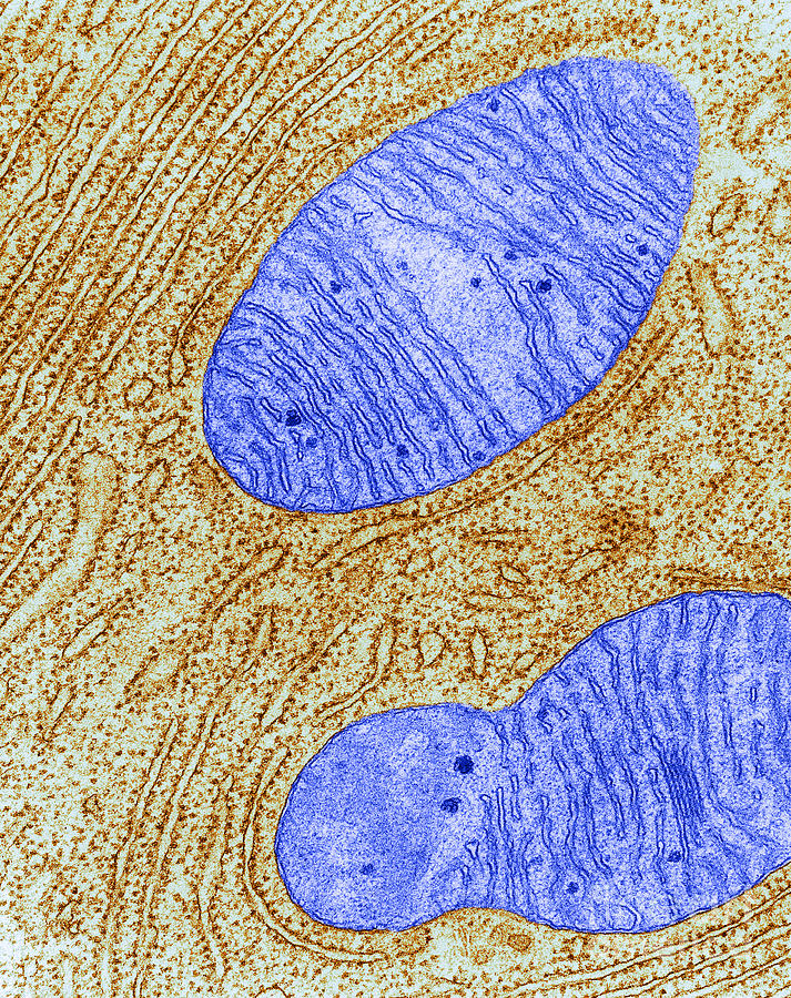 Mitochondrion And Endoplasmic Photograph by Keith R. Porter