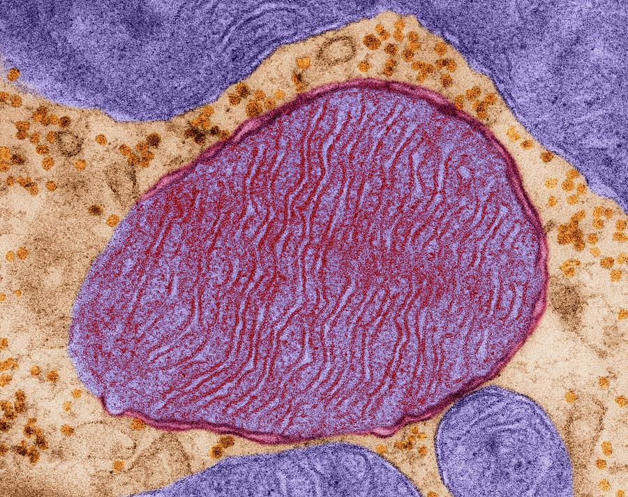 Mitochondrion From A Heart Muscle Cell Photograph by Dennis Kunkel Microscopy/science Photo Library
