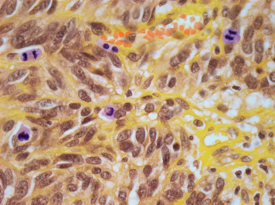 Mitotic Index Photograph by Steve Gschmeissner Biology Diagrams