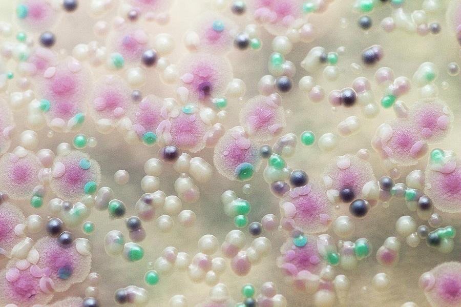 Candida Albicans Photograph - Mixed Culture Of Candida Yeasts by Daniela Beckmann / Science Photo Library