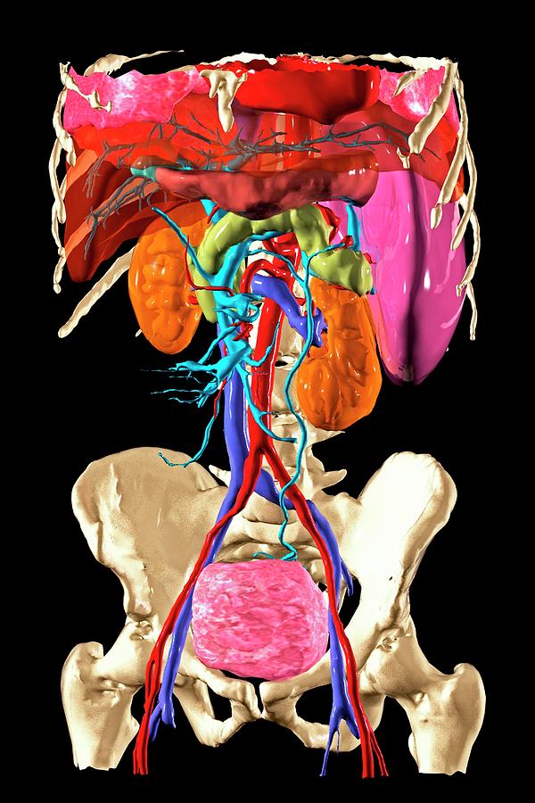 Model For Use In Augmented Surgery Photograph By Patrick Landmann 