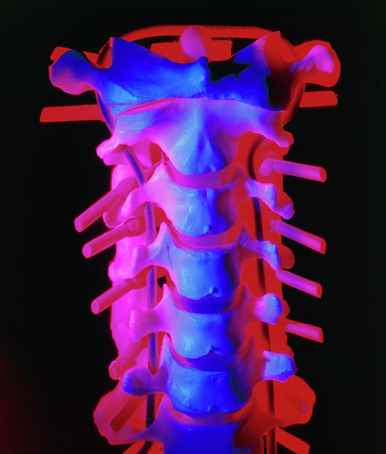 Intervertebral Disc Photograph - Model Of The Cervical Spine by Alfred Pasieka/science Photo Library
