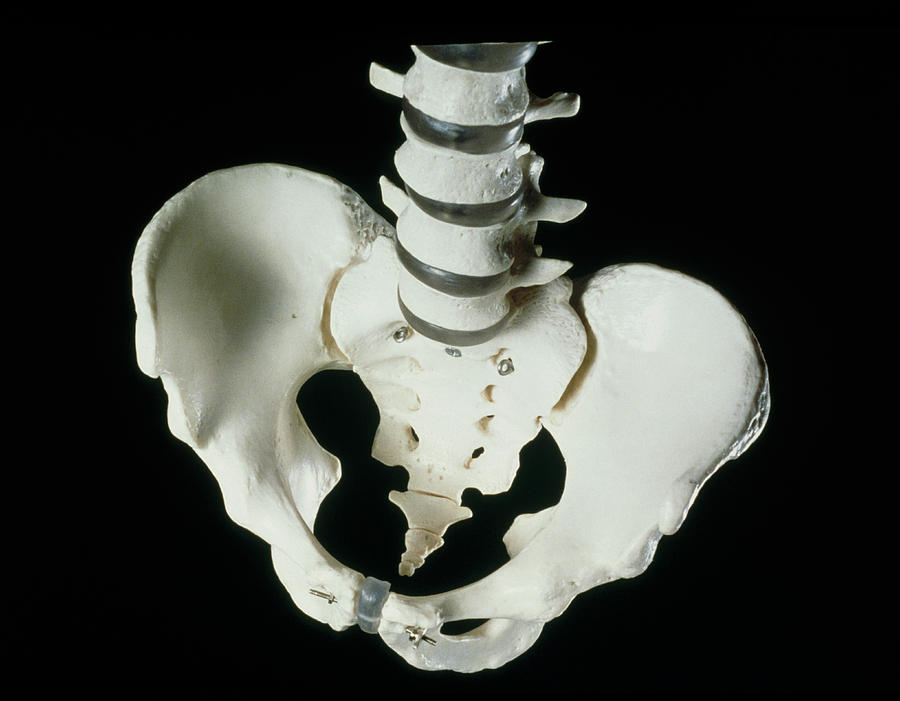 Skeleton Photograph - Model Of The Pelvis And Lower Spinal Vertebrae by Mike Devlin/science Photo Library