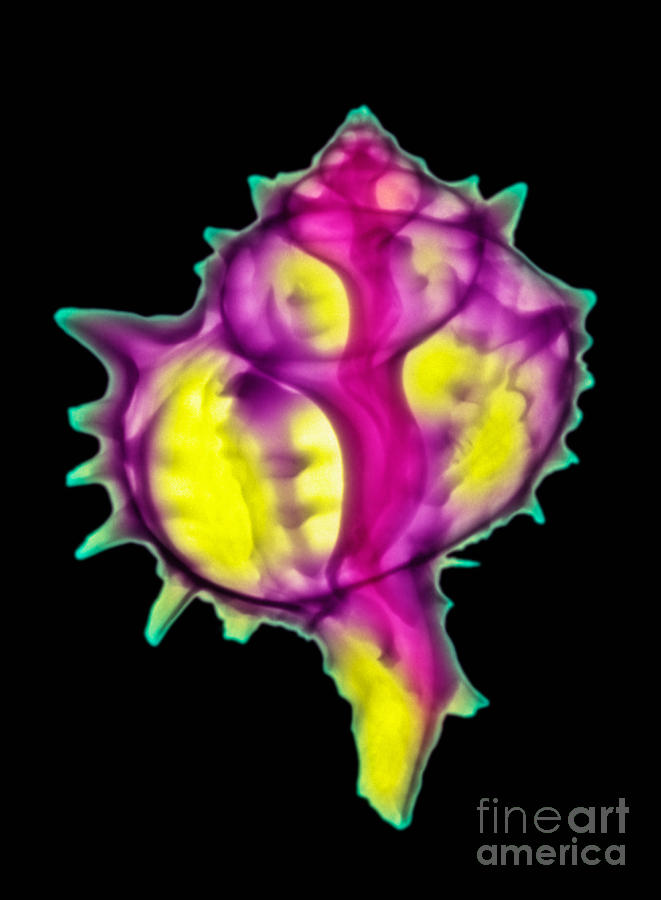 Mollusk Sea Shells , X-ray Photograph by Scott Camazine