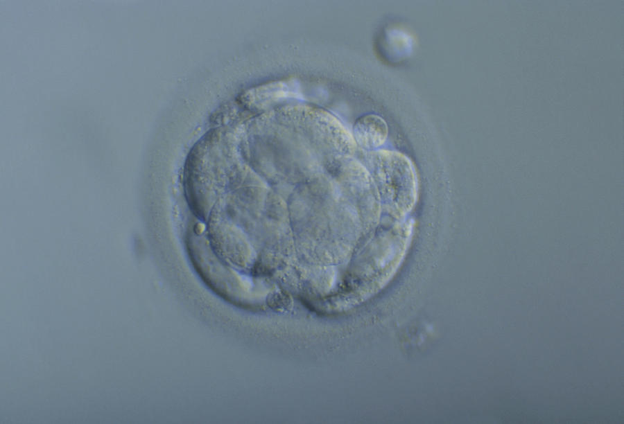 Morula Embryo Photograph by Pascal Goetgheluck/science Photo Library