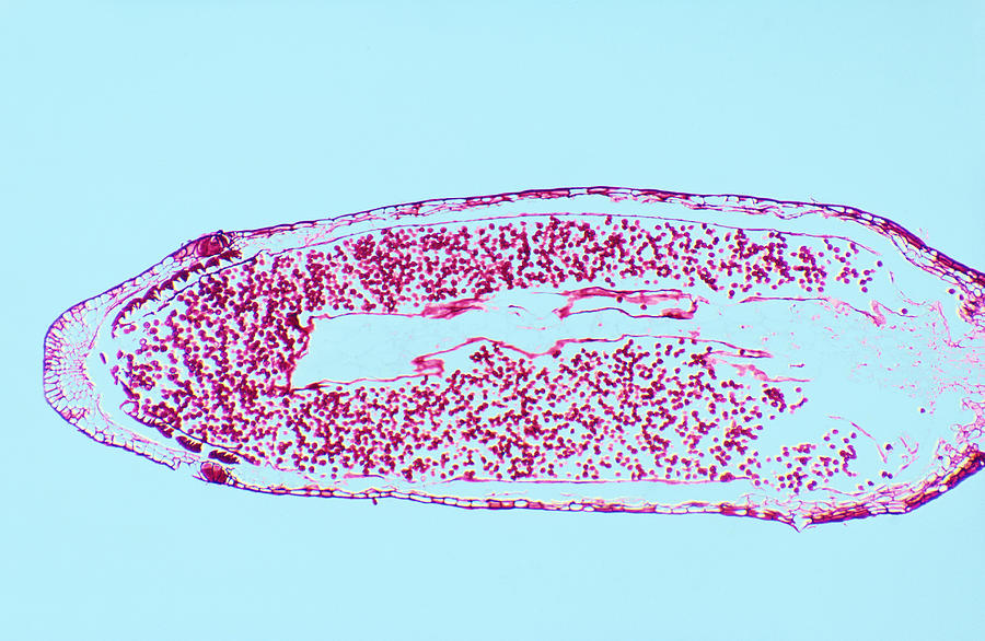 Moss Capsule Photograph by Robert Knauft / Biology Pics