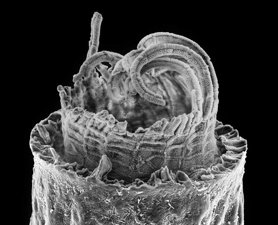 Moss Spore Capsule Photograph by Science Photo Library Moss Spore Capsule Photograph by Science Photo Library