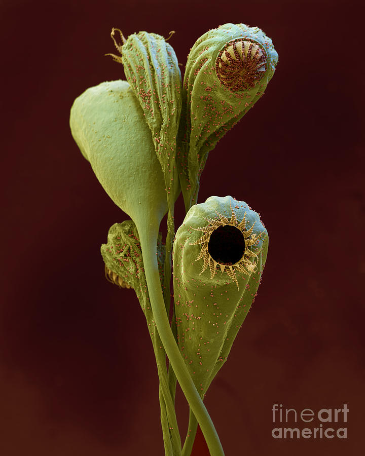 Moss Spore Capsules Photograph by Eye of Science