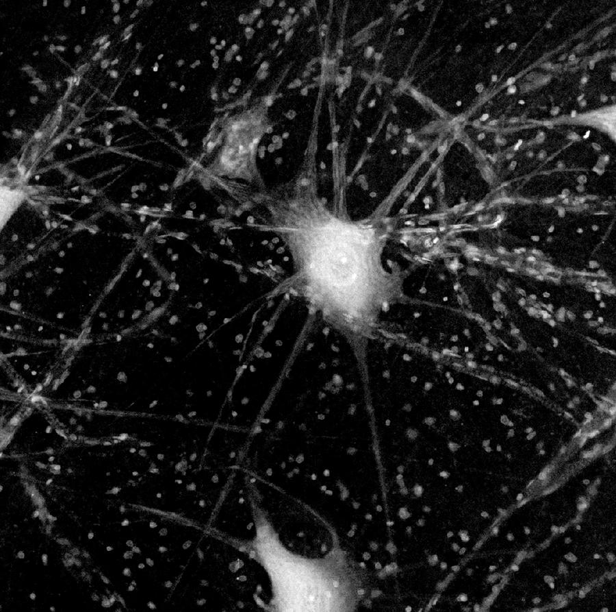 Motor Neurones Photograph by Steve Gschmeissner/science Photo Library