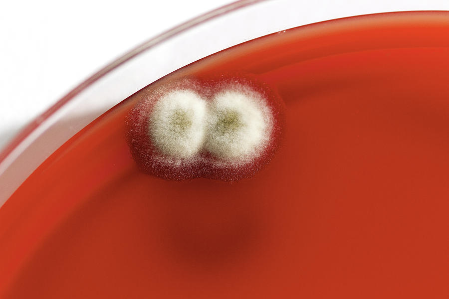 Mould Fungus Culture On Blood Agar Photograph by Science Photo Library ...