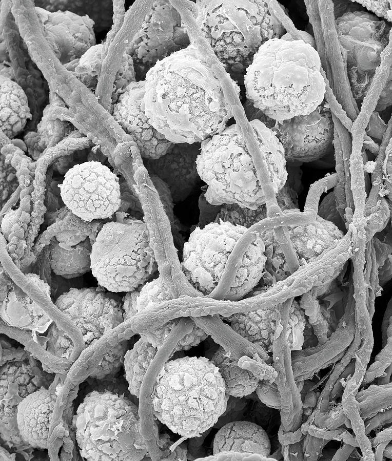 Mould Hyphae And Conidia Epicoccum Nigrum Photograph By Dennis Kunkel Microscopyscience Photo 
