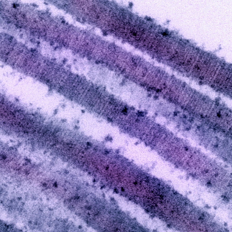 Electron Micrograph Photograph - Mouse Lung Collagen. Tem by Science Stock Photography Electron Micrograph Photograph - Mouse Lung Collagen. Tem by Science Stock Photography