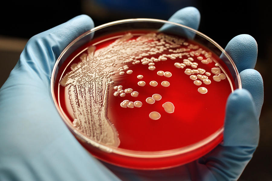 MRSA colonies on blood agar plate Photograph by Rodolfo Parulan Jr