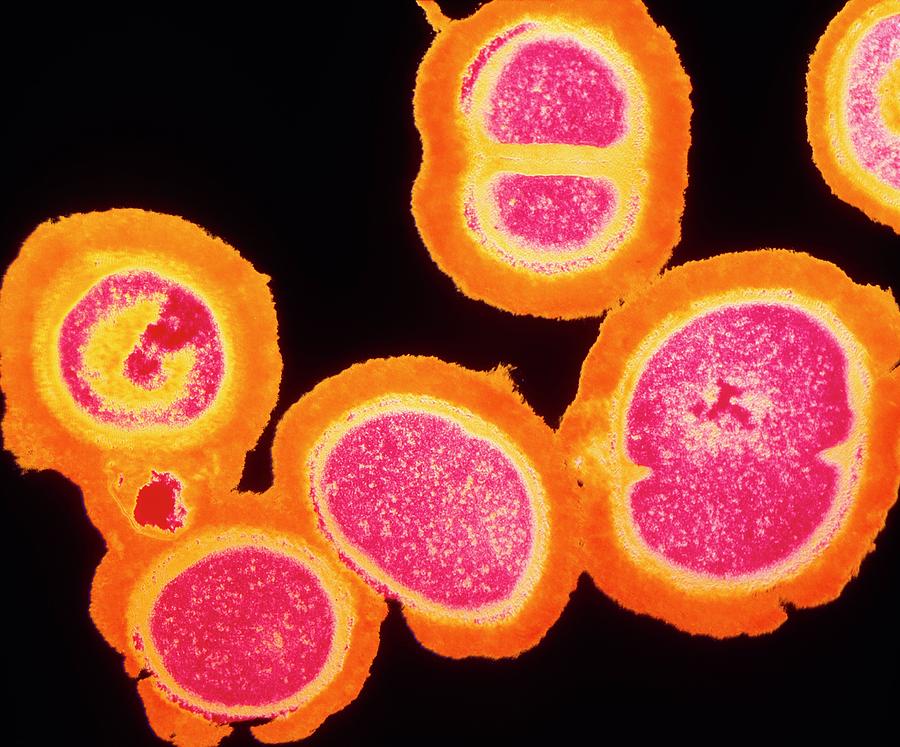 Mrsa Resistant Staphylococcus Bacteria Photograph by Dr Kari Lounatmaa/science Photo Library