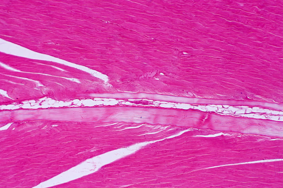 Muscle And Tendon Junction, Lm Photograph by Science Stock Photography ... Biology Diagrams