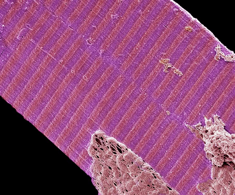 Muscle Fibre Photograph by David Mccarthy