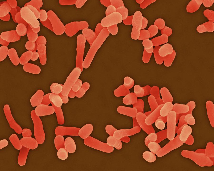 Animal Photograph - Mycobacterium Avium by Dennis Kunkel Microscopy/science Photo Library