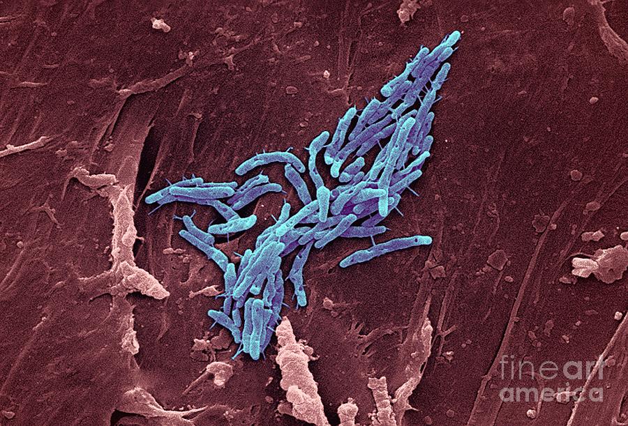 Abnormal Photograph - Mycobacterium Fortuitum Bacteria by Ami Images