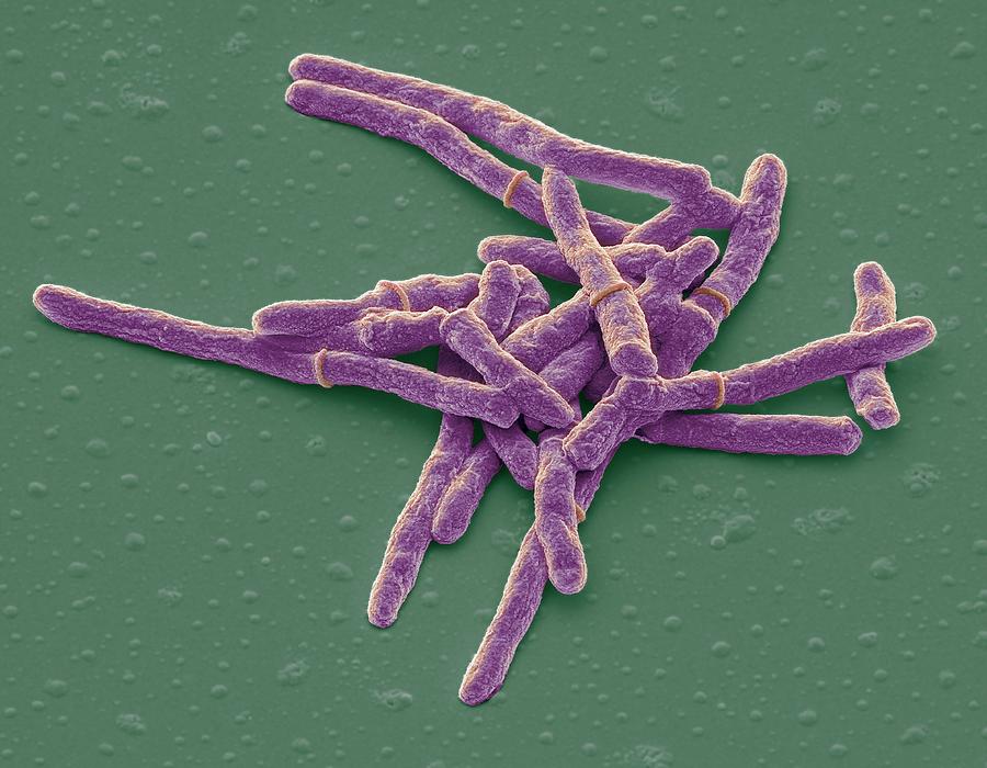 Mycobacterium Smegmatis Bacteria Photograph by Steve Gschmeissner