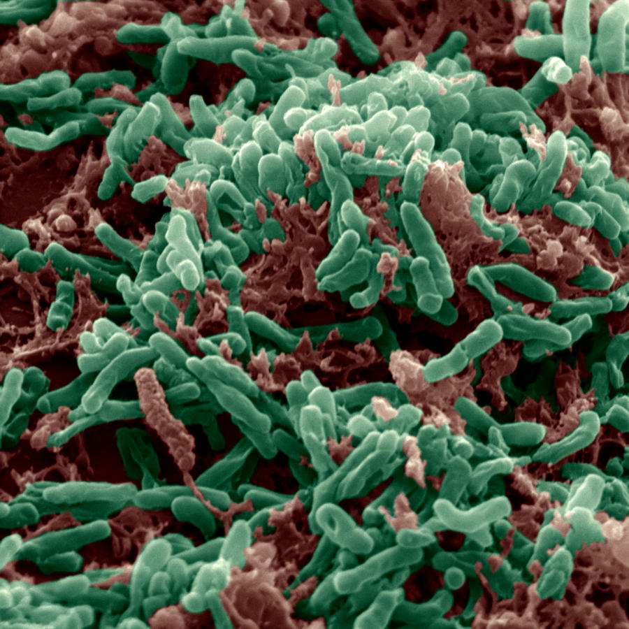 Mycobacterium Tuberculosis Photograph by Eye of Science
