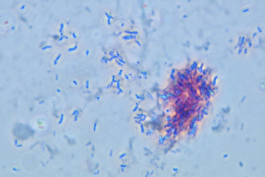 Mycobacterium Tuberculosis Photograph by Michael Abbey