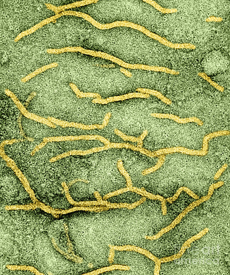 Mycobacterium Tuberculosis #9 Photograph by Kwangshin Kim