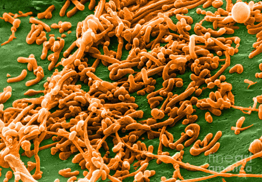 Bacterial Photograph - Mycoplasma Bacteria, Sem by David M. Phillips