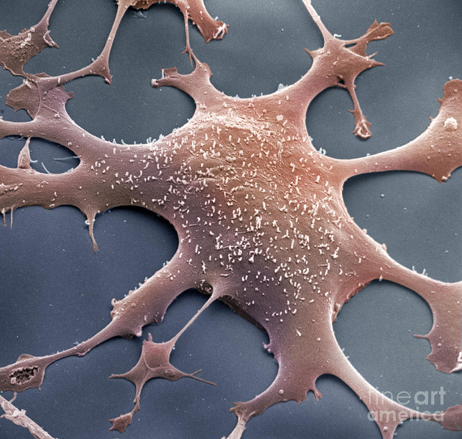 Mycoplasma Photograph by David M. Phillips