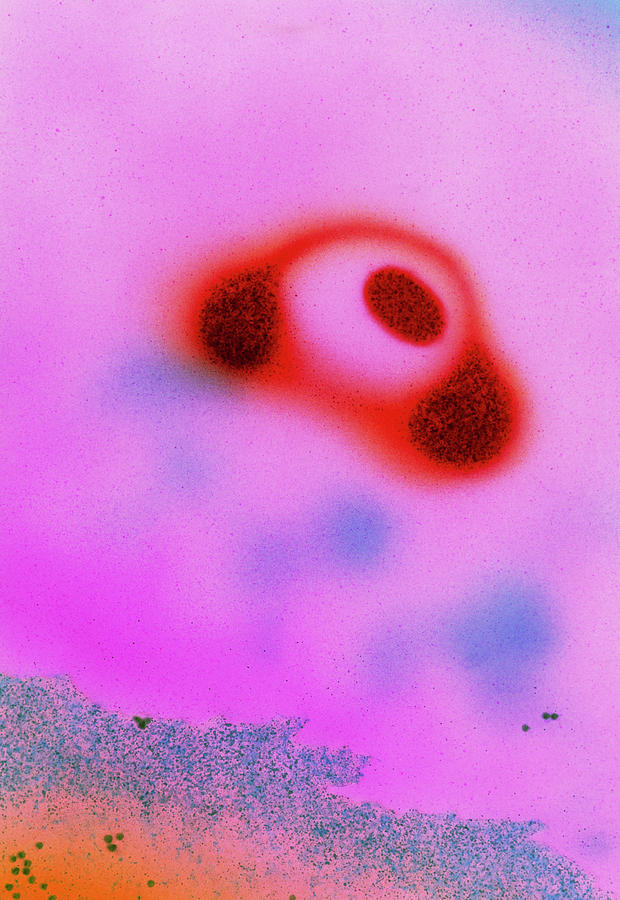 Mycoplasma Pneumoniae Bacteria Photograph by Dr Kari Lounatmaa/science Photo Library